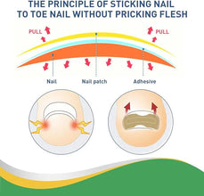 Toenail Correction Patch