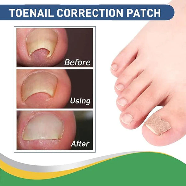 Toenail Correction Patch